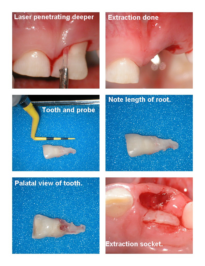 Pediatric Extraction pg 2.jpg